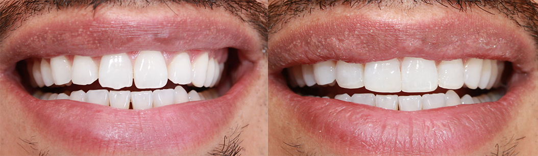 Jonathan Ochi DDS | Sleep Apnea, All-on-6 and Preventative Program