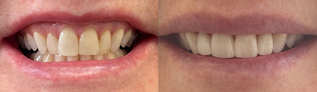 Jonathan Ochi DDS | ZOOM  Whitening, Periodontal Treatment and Sports Mouthguards