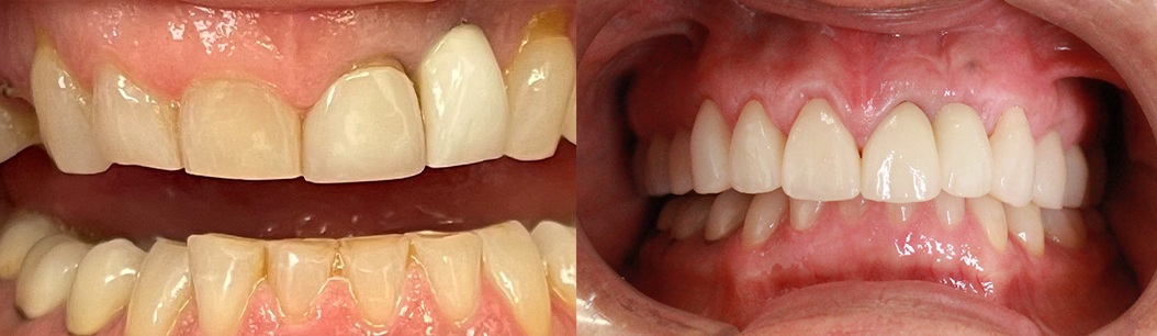 Jonathan Ochi DDS | ZOOM  Whitening, Night Guards and Preventative Program