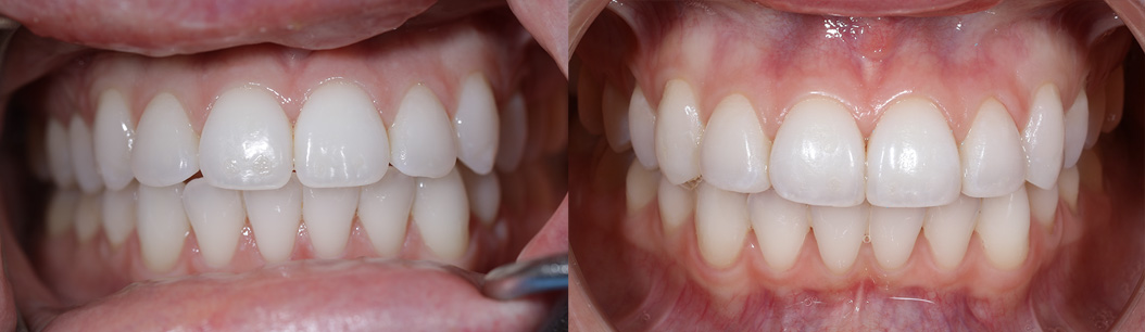 Jonathan Ochi DDS | Digital Radiography, CBCT and Night Guards